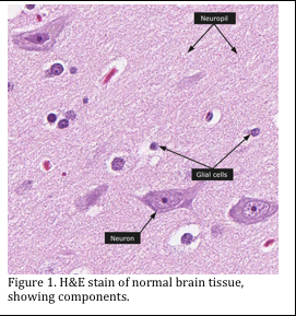 fig1