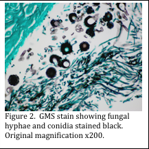 gms stain