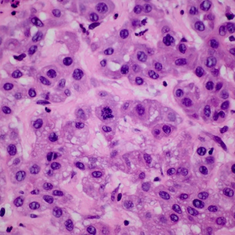 Fig 2A – Optimal fixation. Note nuclear detail. Original magnification x 60.