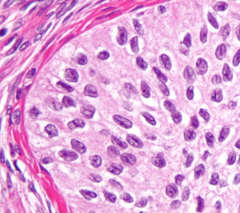 Fig 2B – Suboptimal fixation. Note poor nuclear detail. Original magnification x 60.