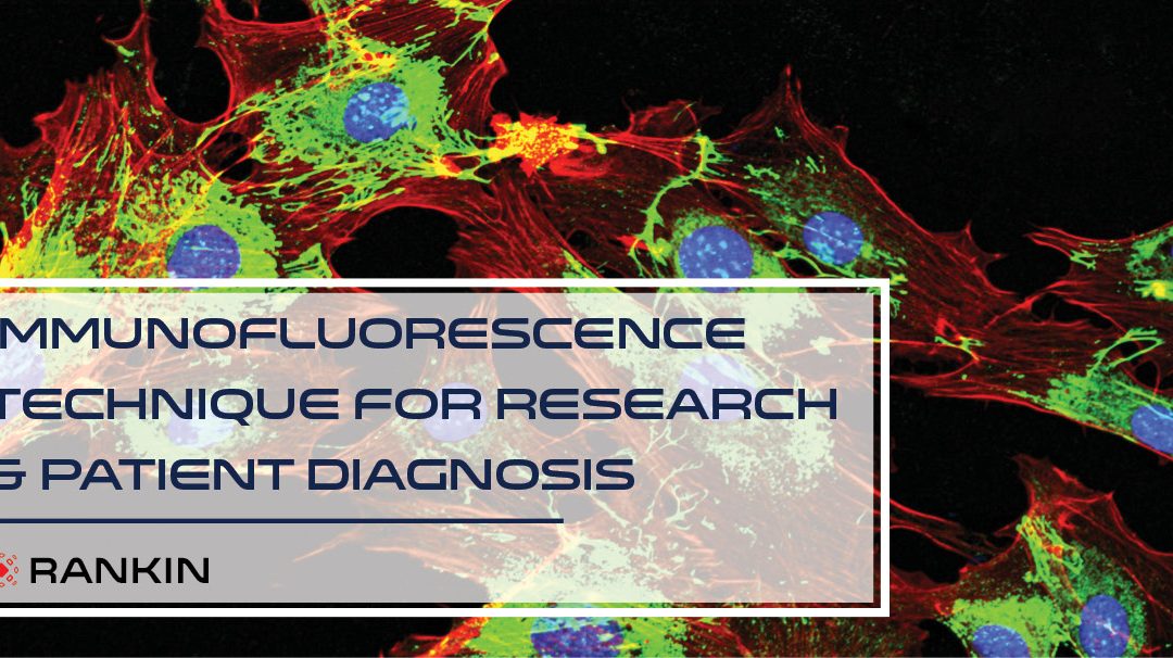 #2 Immunofluorescence