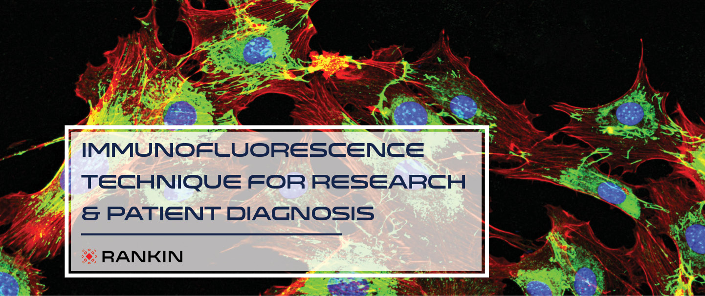 #2 Immunofluorescence