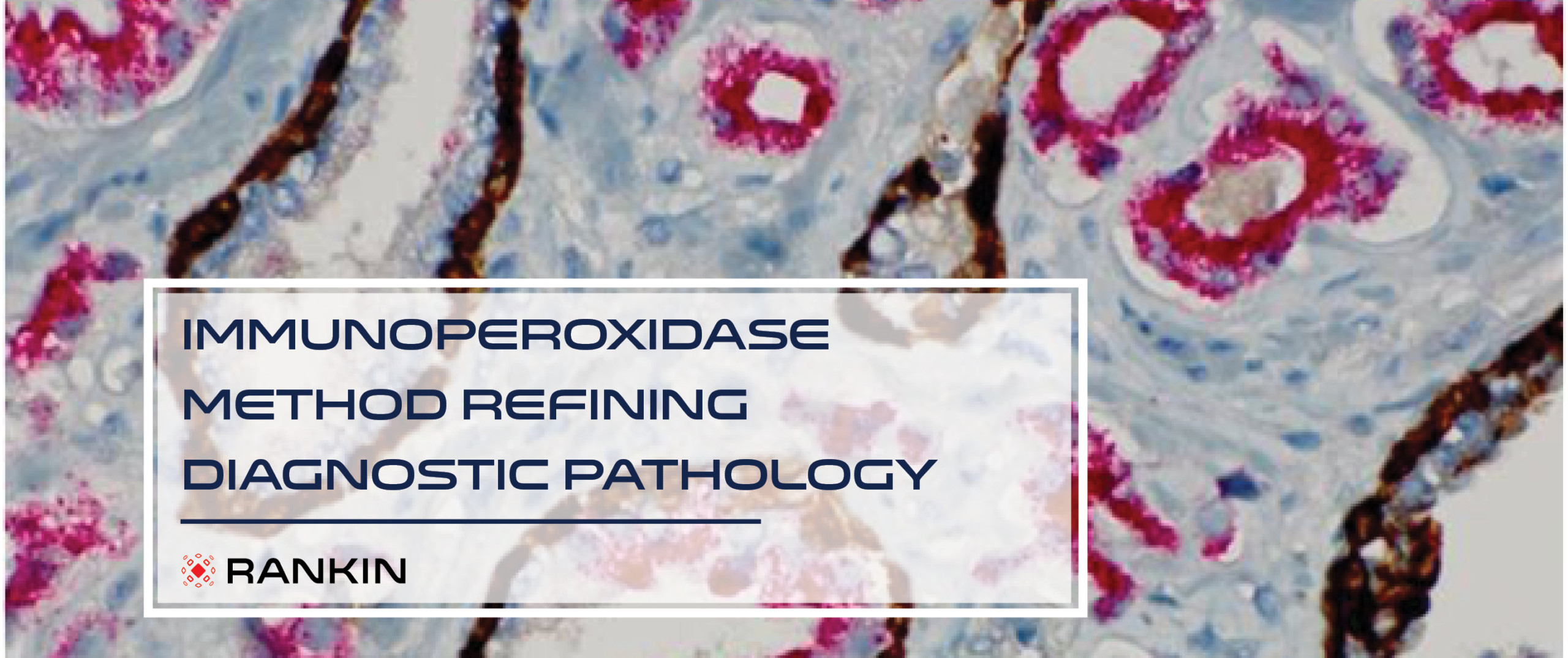 #3: Immunoperoxidase